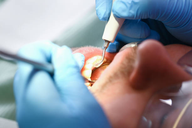 Best Knocked-Out Tooth Emergency  in Lovell, WY