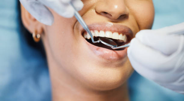 Best Urgent Tooth Repair  in Lovell, WY